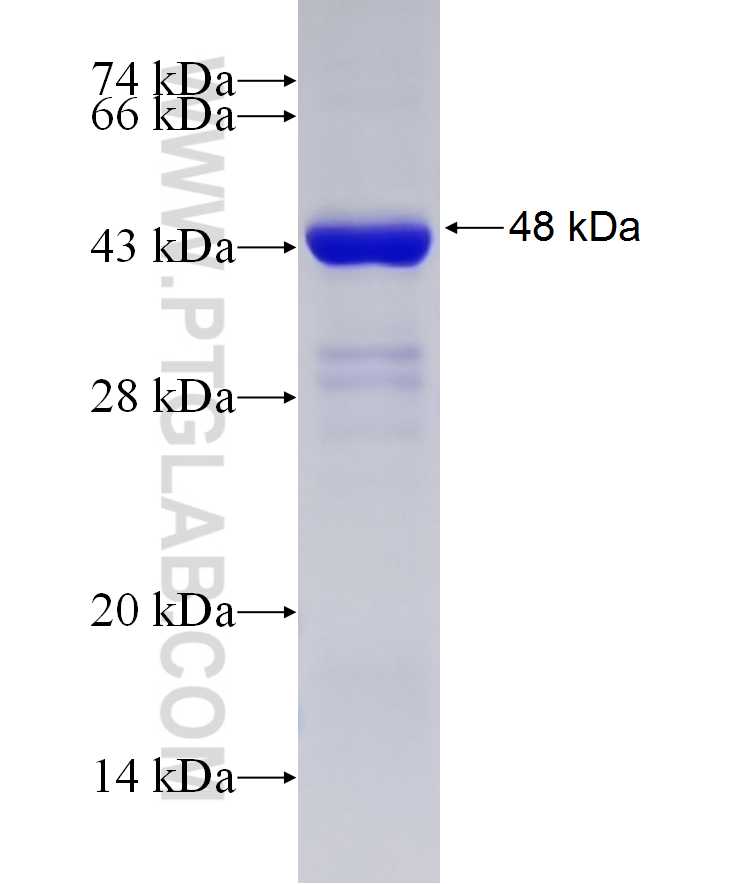 MAP3K11 fusion protein Ag29748 SDS-PAGE MAP3K11 fusion protein Ag29748 SDS-PAGE