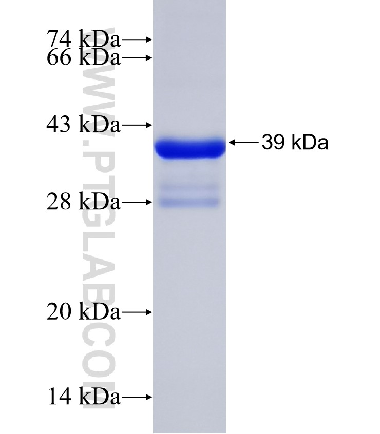 MAP3K11 fusion protein Ag31461 SDS-PAGE MAP3K11 fusion protein Ag31461 SDS-PAGE