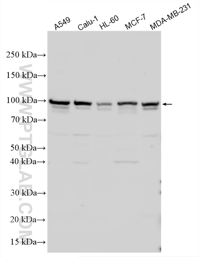 Various lysates were subjected to SDS PAGE followed by western blot with 14054-1-AP (DLK/MAP3K12 antibody) at dilution of 1:2500 incubated at room temperature for 1.5 hours. WB analysis using 14054-1-AP