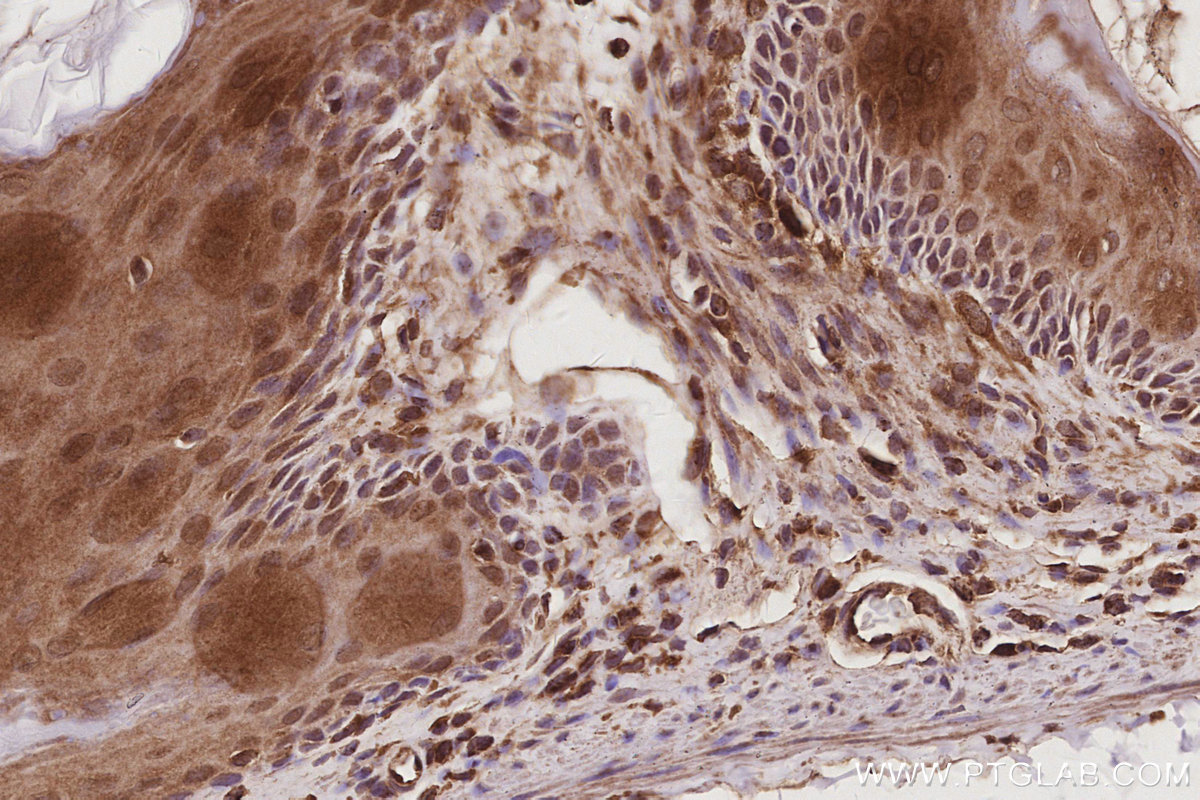 IHC staining of mouse stomach using 29265-1-AP IHC staining of mouse stomach using 29265-1-AP