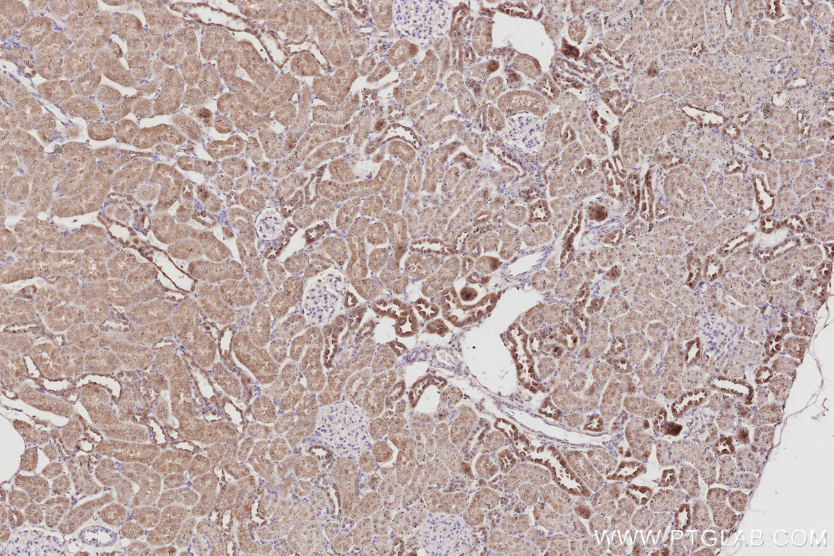 IHC staining of rat kidney using 29265-1-AP IHC staining of rat kidney using 29265-1-AP