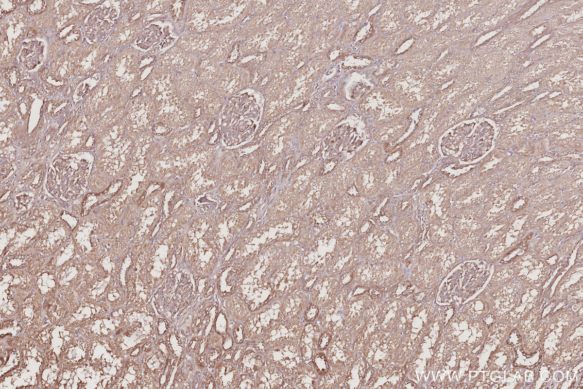 IHC staining of human kidney using 29265-1-AP IHC staining of human kidney using 29265-1-AP