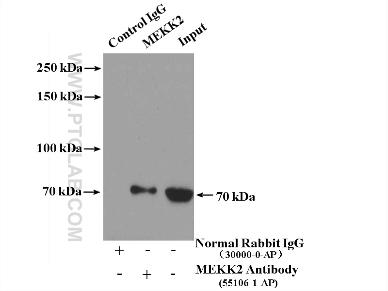 IP experiment of HEK-293 using 55106-1-AP