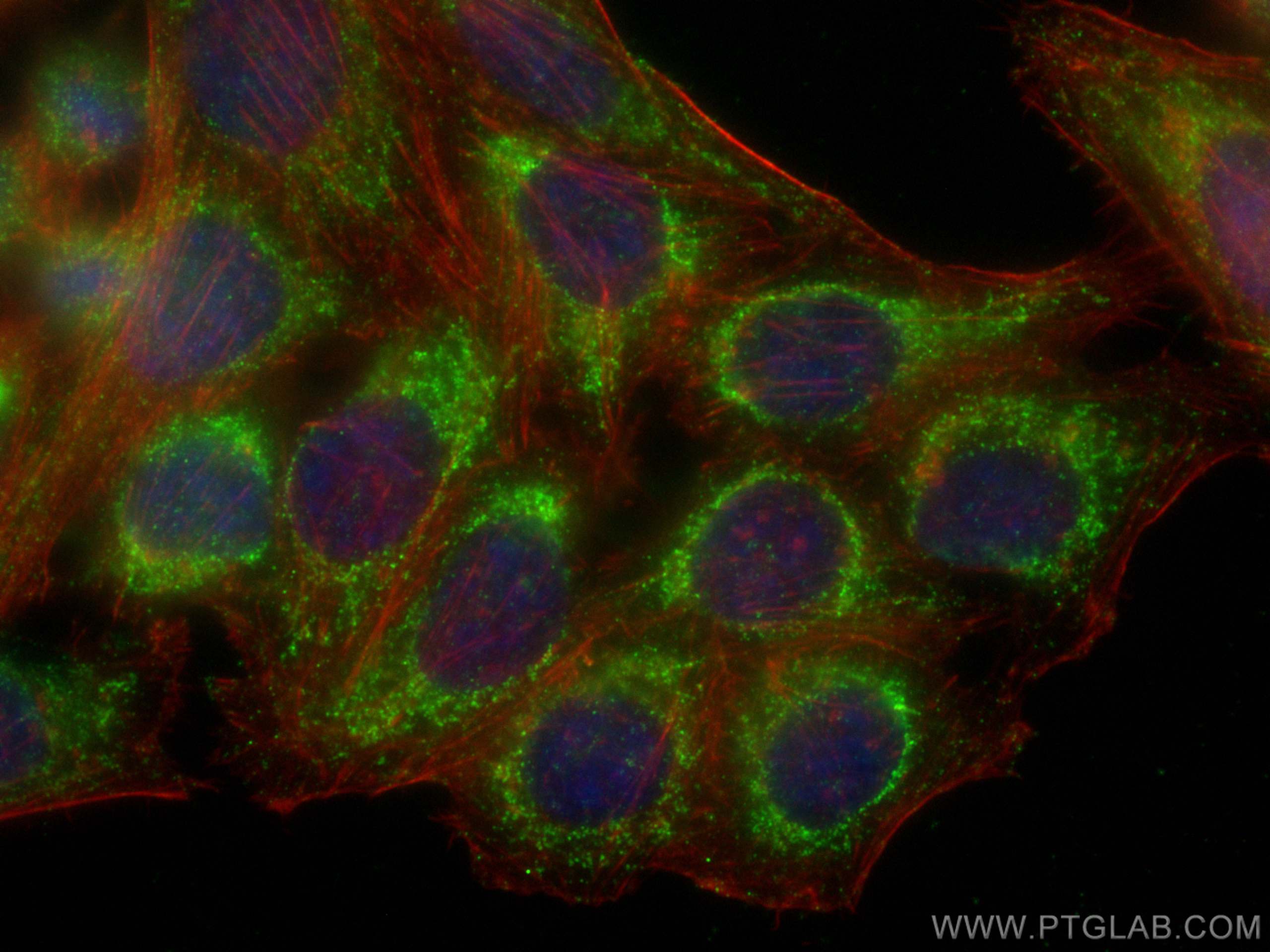 IF Staining of HepG2 using 67707-1-Ig (same clone as 67707-1-PBS)
