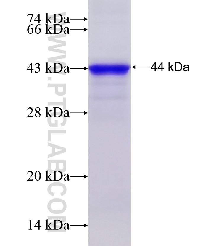 MAP3K7IP2 fusion protein Ag5917 SDS-PAGE