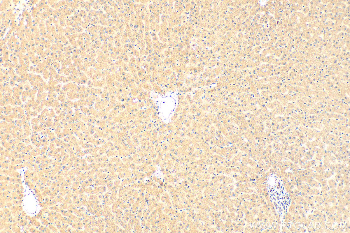 IHC staining of human liver using 23950-1-AP