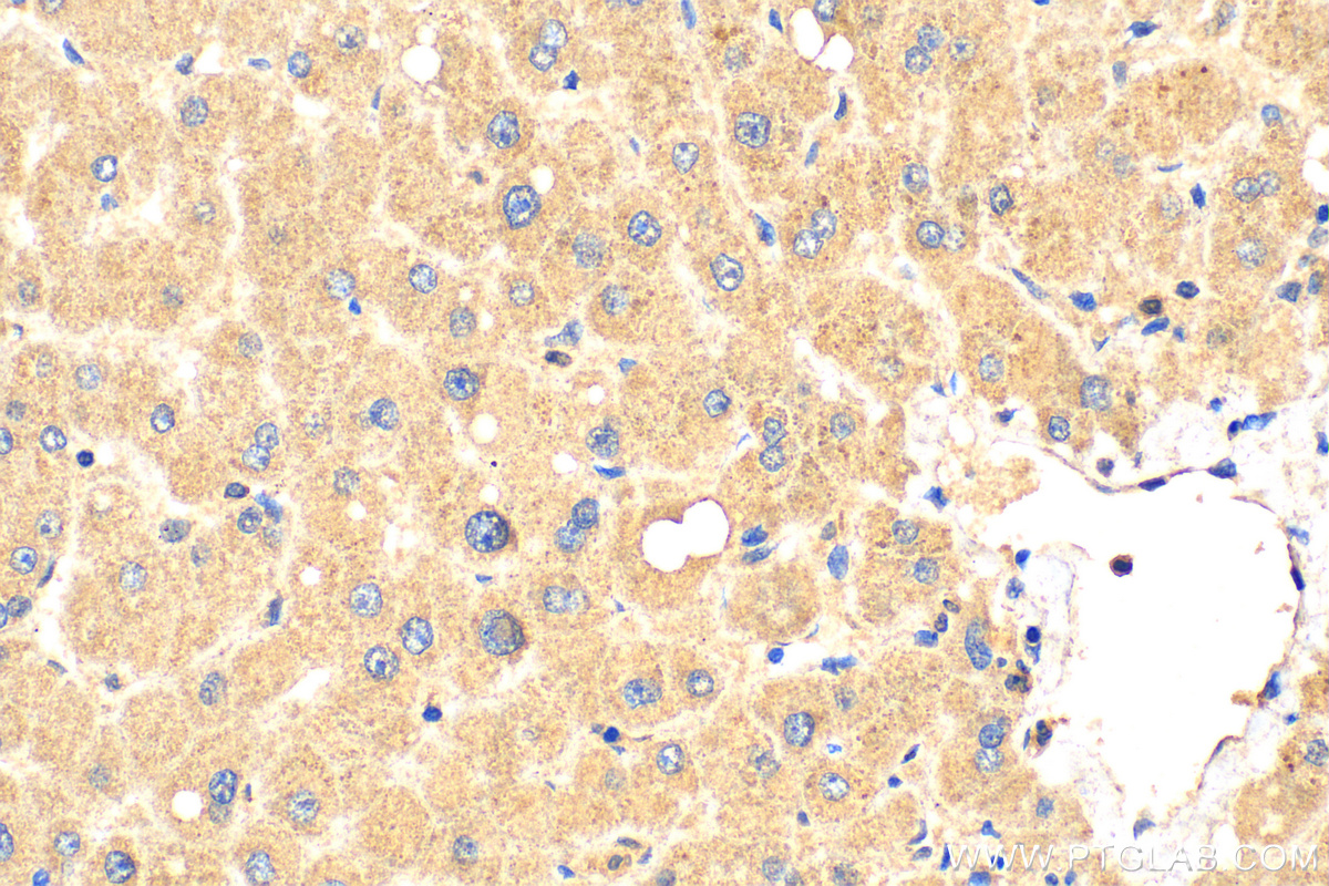 IHC staining of human liver using 23950-1-AP