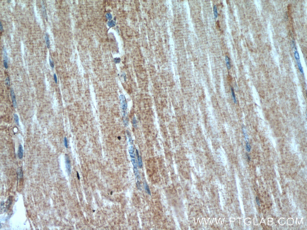 IHC staining of human skeletal muscle using 14702-1-AP