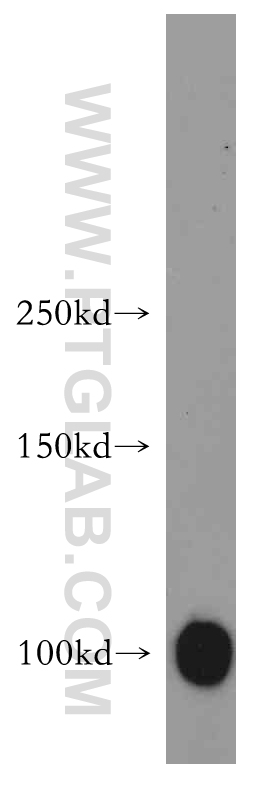 WB analysis of human skeletal muscle using 14702-1-AP