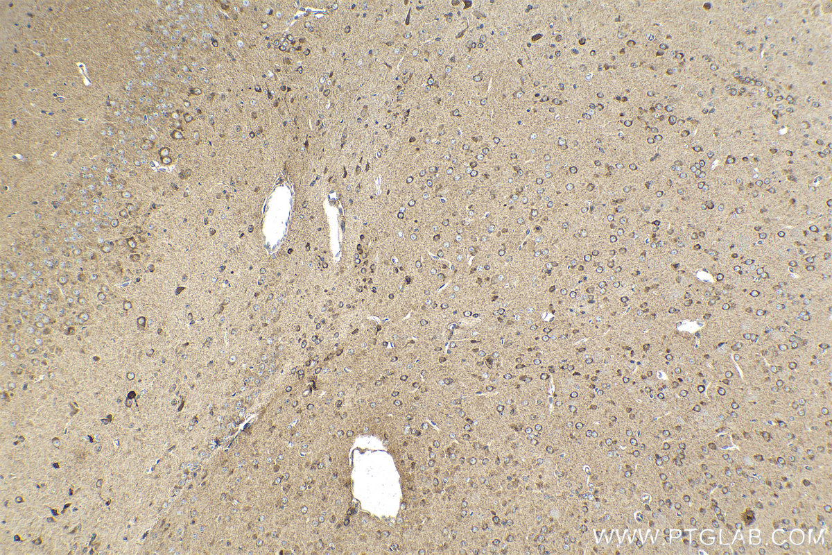 IHC staining of mouse brain using 55247-1-AP (same clone as 55247-1-PBS) IHC staining of mouse brain using 55247-1-AP (same clone as 55247-1-PBS)