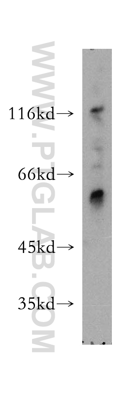 WB analysis of mouse ovary using 12827-1-AP