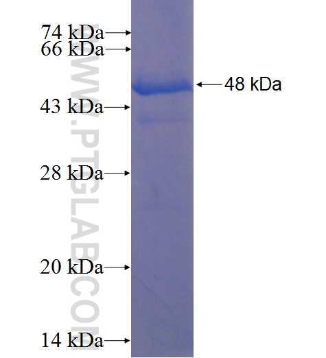 MAP6 fusion protein Ag22850 SDS-PAGE MAP6 fusion protein Ag22850 SDS-PAGE
