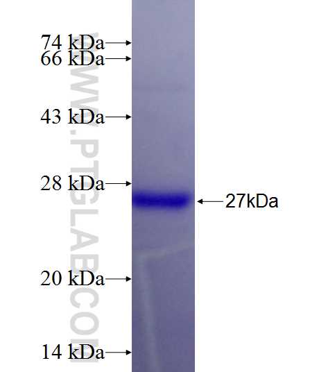 MAP6 fusion protein Ag26417 SDS-PAGE MAP6 fusion protein Ag26417 SDS-PAGE