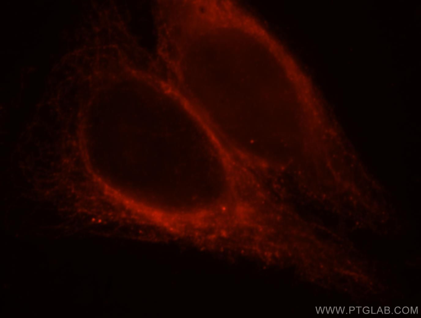 IF Staining of HepG2 using 13446-1-AP