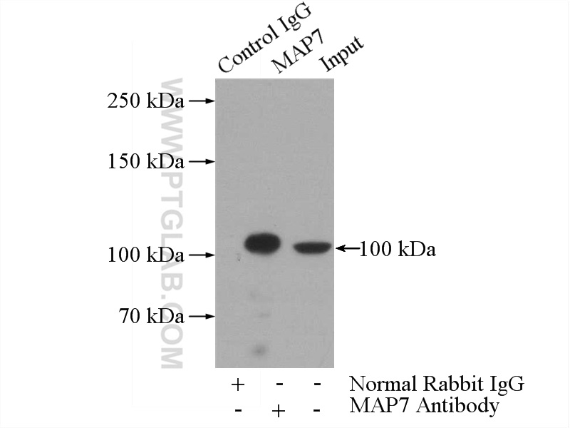 IP experiment of HeLa using 13446-1-AP