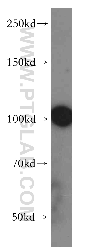 WB analysis of A549 using 13446-1-AP