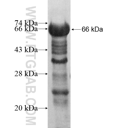 MAP7 fusion protein Ag14481 SDS-PAGE MAP7 fusion protein Ag14481 SDS-PAGE