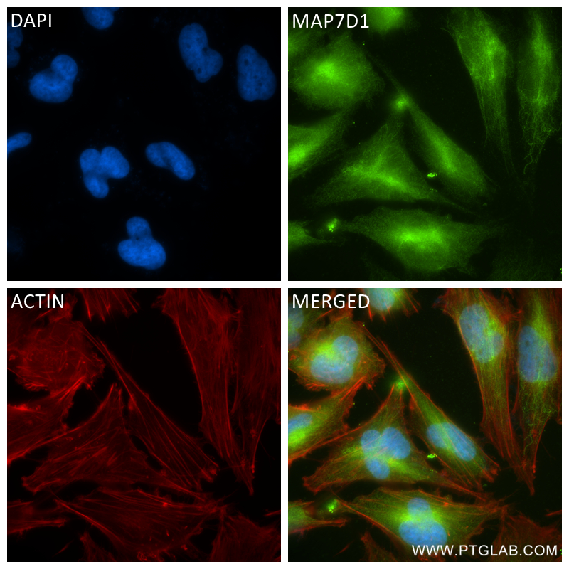IF Staining of U-251 using 83173-1-RR (same clone as 83173-1-PBS)