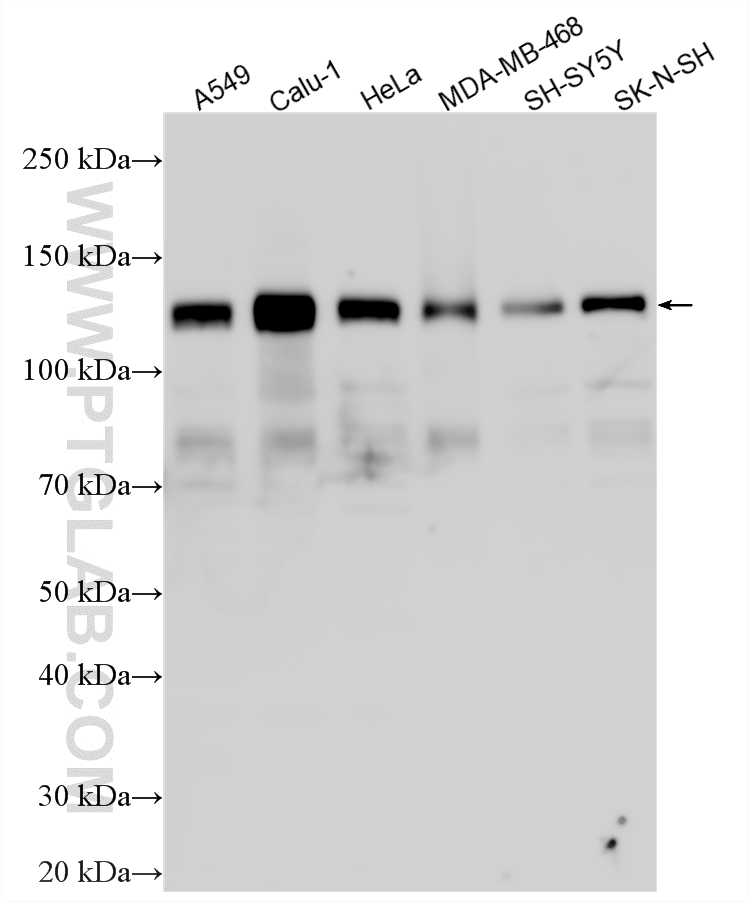 WB analysis using 27573-1-AP (same clone as 27573-1-PBS)
