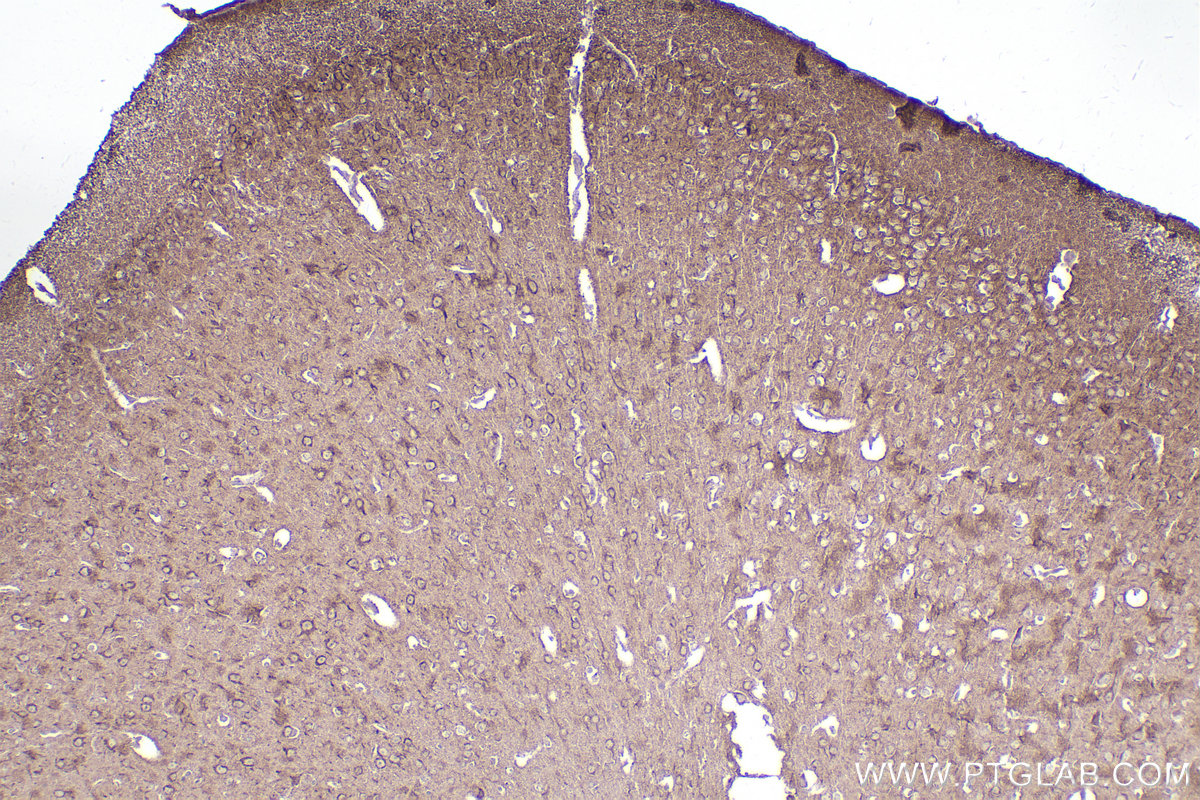 IHC staining of mouse brain using 26078-1-AP