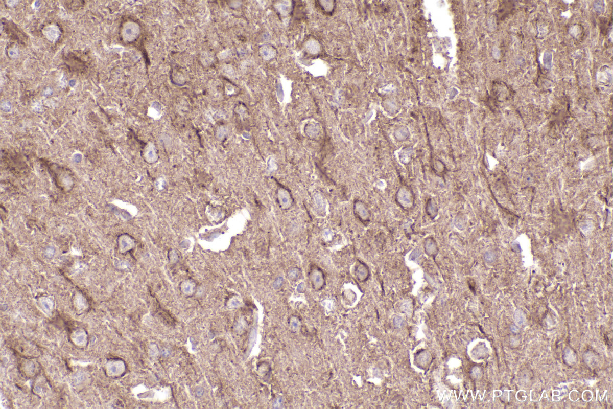 IHC staining of mouse brain using 26078-1-AP