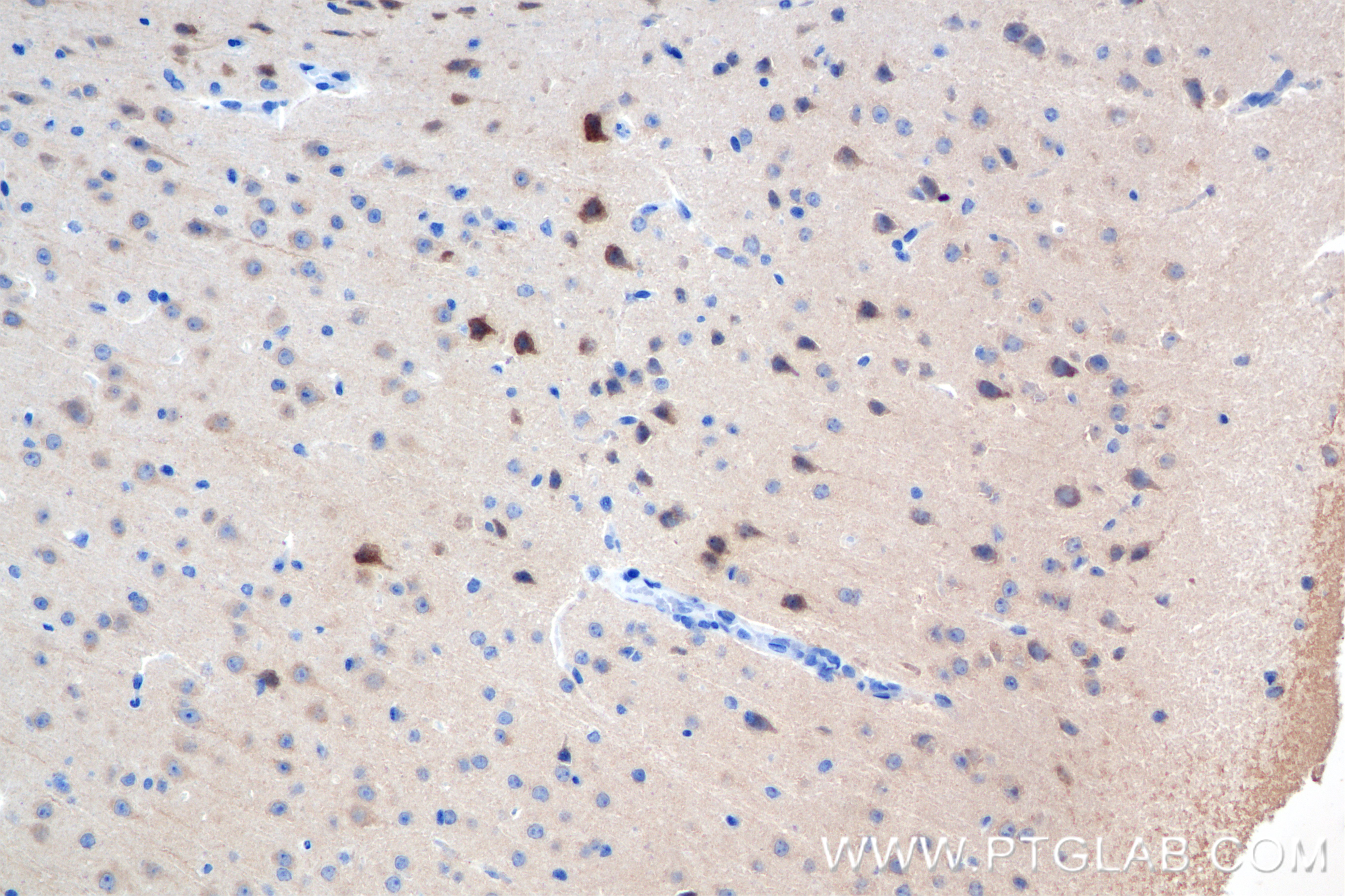 IHC staining of mouse brain using 84875-5-RR (same clone as 84875-5-PBS)