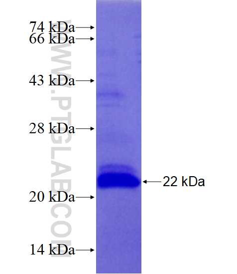 MAPK10 fusion protein Ag27840 SDS-PAGE MAPK10 fusion protein Ag27840 SDS-PAGE
