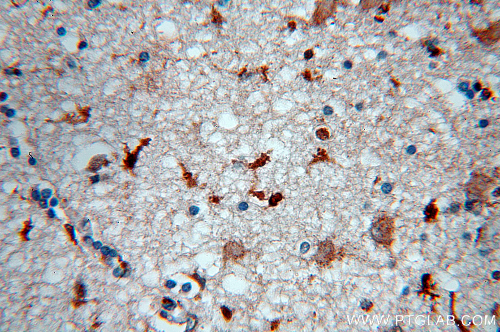 IHC staining of human brain using 17376-1-AP