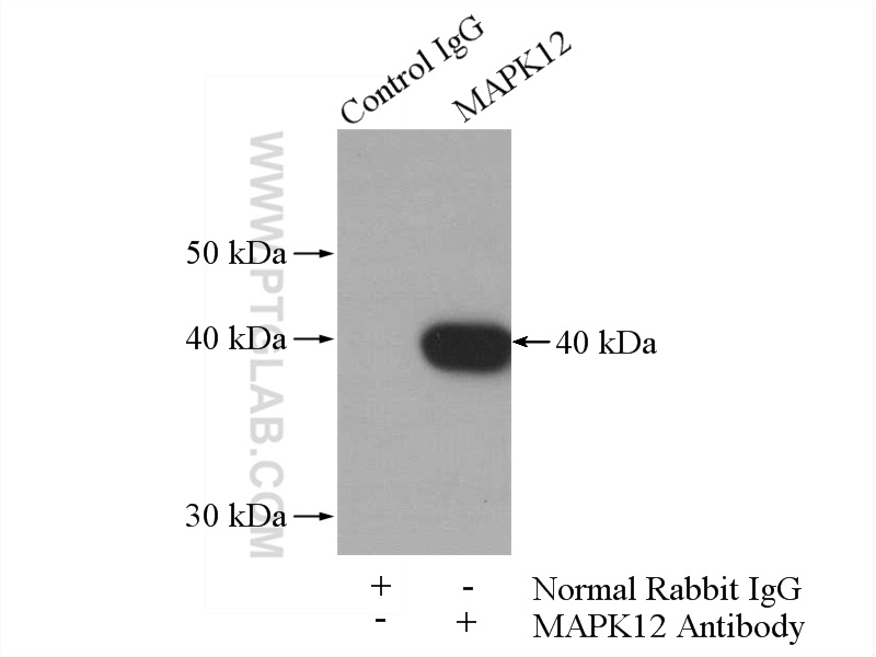 IP experiment of mouse skeletal muscle using 20184-1-AP