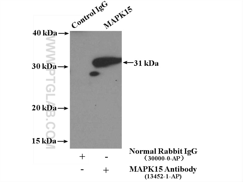 IP experiment of mouse lung using 13452-1-AP