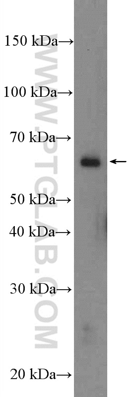 WB analysis of mouse lung using 13452-1-AP