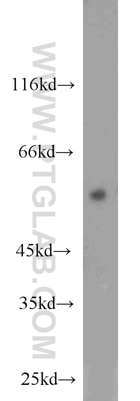 ERK5