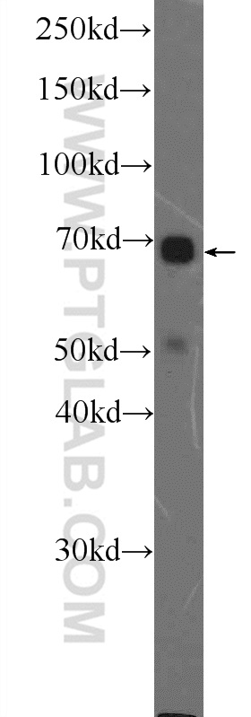 WB analysis of SKOV-3 using 11164-1-AP