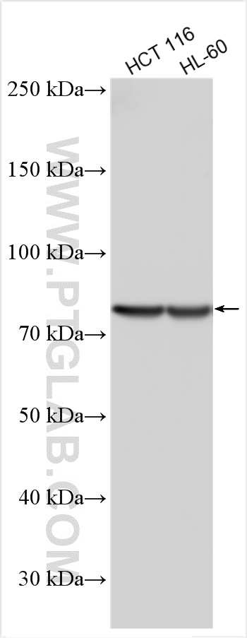 WB analysis using 11164-1-AP