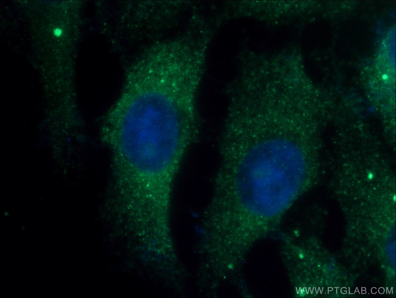 IF Staining of SH-SY5Y using 17337-1-AP