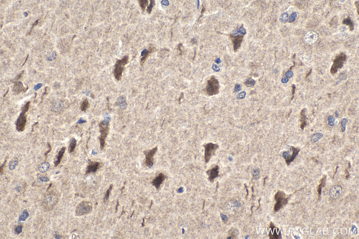 IHC staining of rat brain using 17337-1-AP