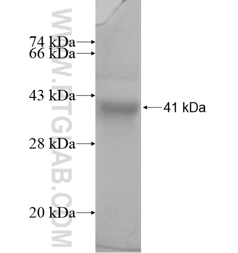 JNK2 fusion protein Ag11126 SDS-PAGE JNK2 fusion protein Ag11126 SDS-PAGE