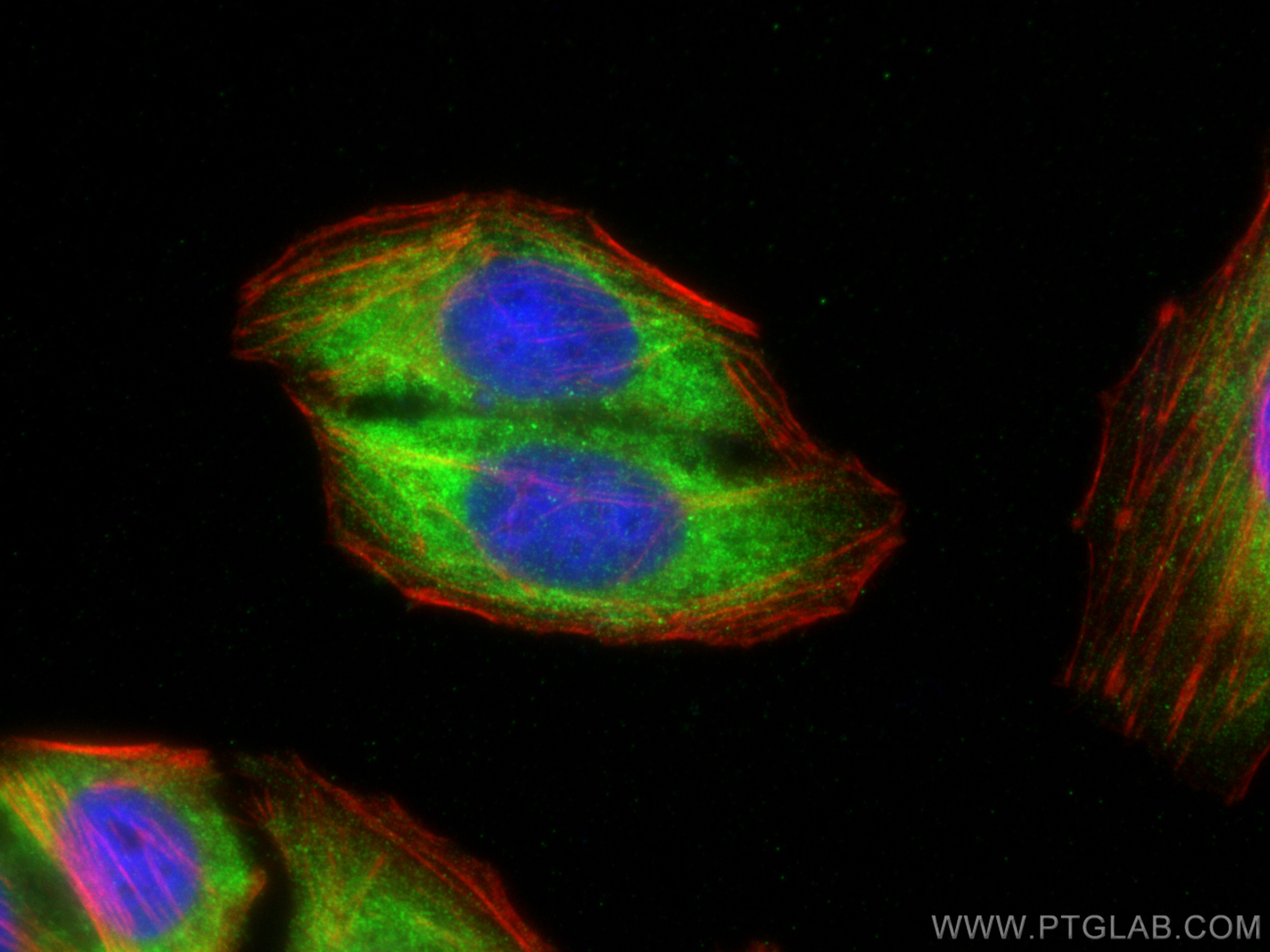 IF Staining of HepG2 using 15463-1-AP