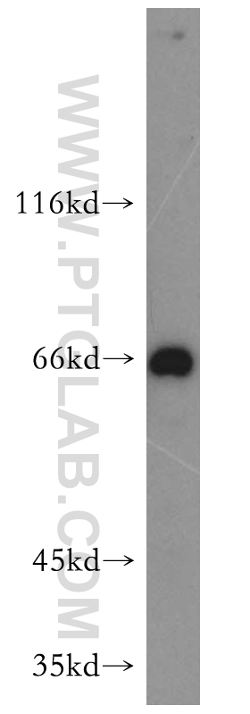 WB analysis of mouse kidney using 15463-1-AP