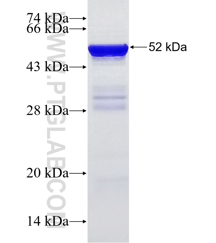 MAPKAPK2 fusion protein Ag16027 SDS-PAGE