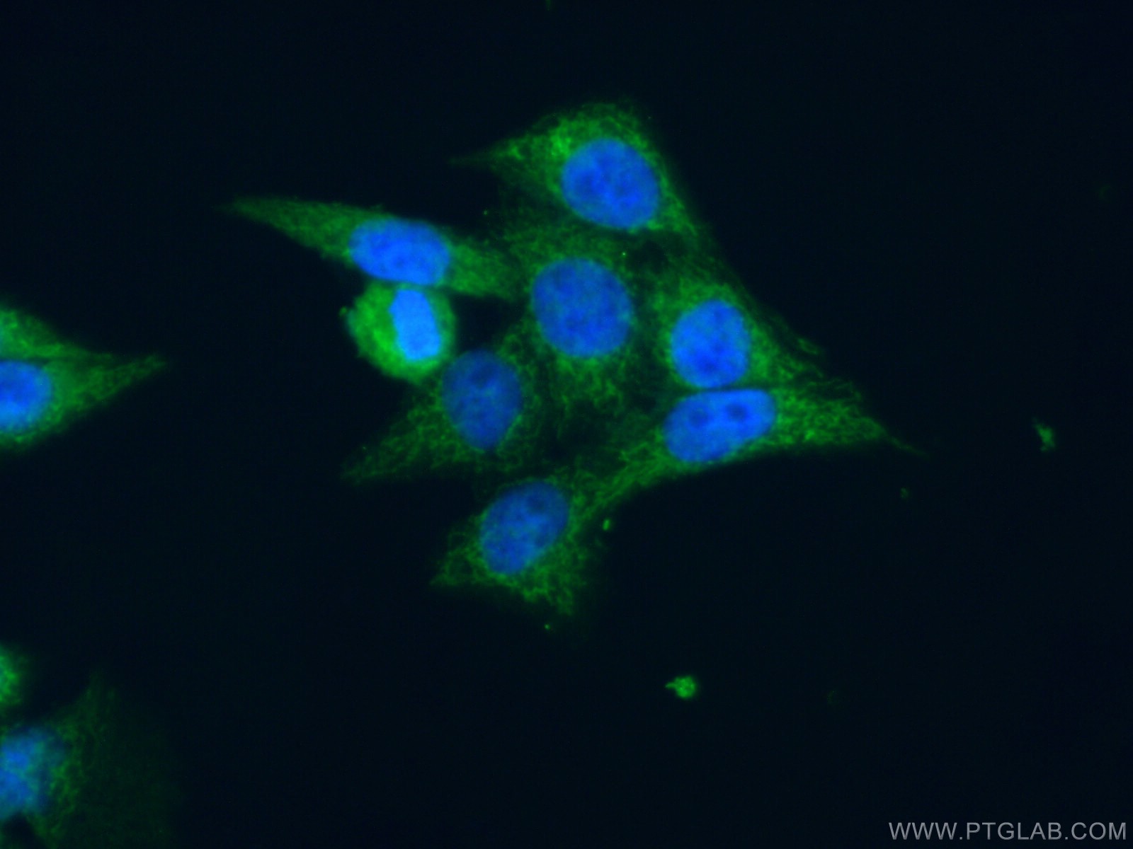 IF Staining of HeLa using 15424-1-AP