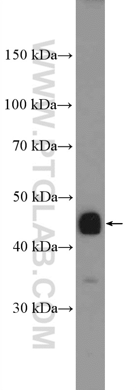 WB analysis of mouse skeletal muscle using 15424-1-AP