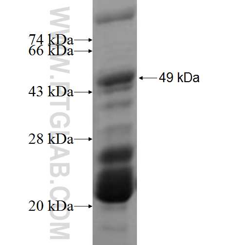 MAPKAPK3 fusion protein Ag0320 SDS-PAGE MAPKAPK3 fusion protein Ag0320 SDS-PAGE