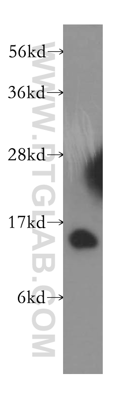 MAPKSP1 Polyclonal antibody