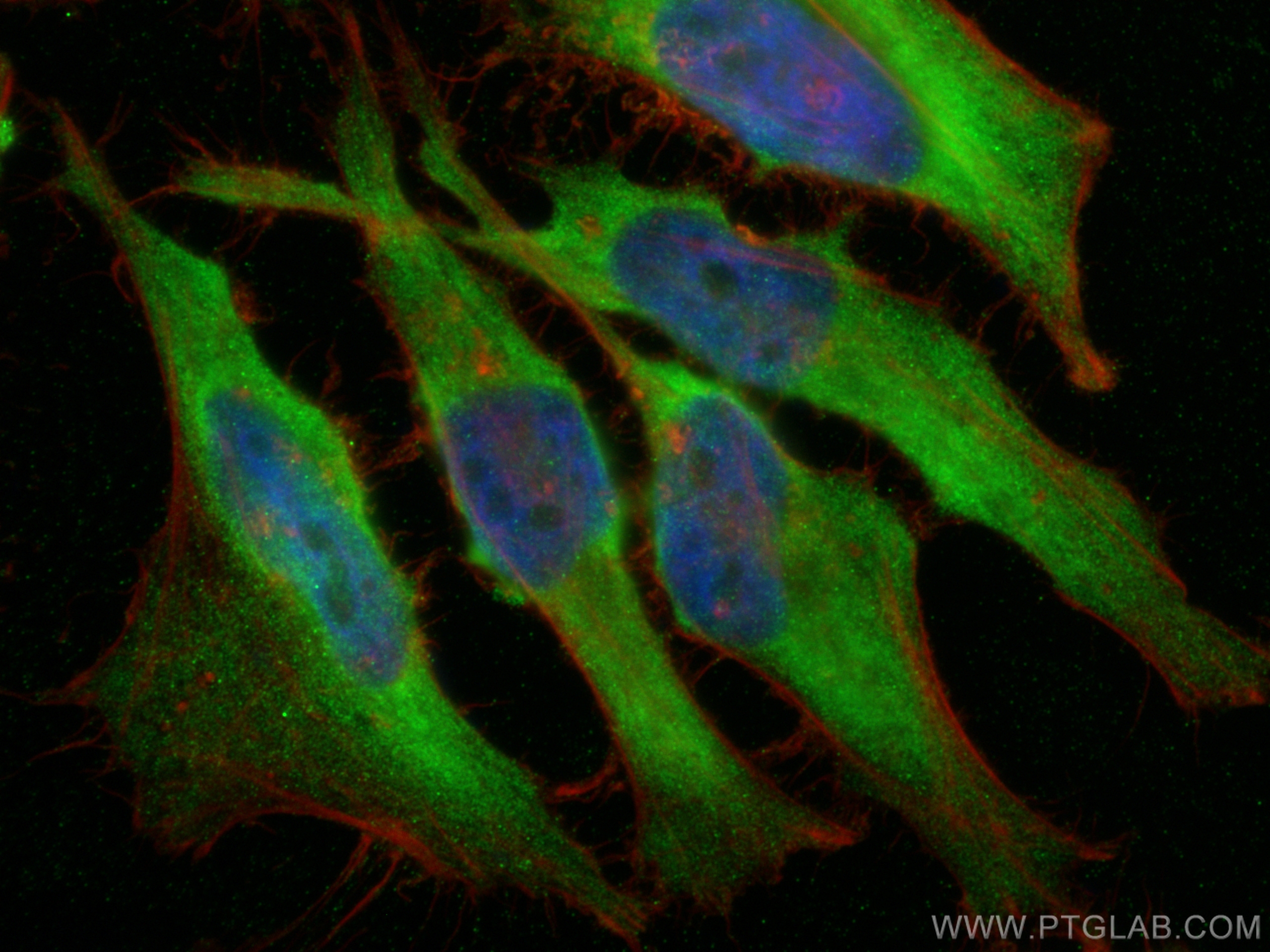 IF Staining of HeLa using 17717-1-AP