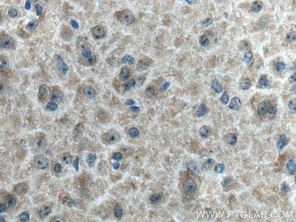 Immunohistochemical analysis of paraffin-embedded mouse brain tissue slide using 23974-1-AP (EB3 antibody) at dilution of 1:200 (under 40x lens). Heat mediated antigen retrieval with Tris-EDTA buffer (pH 9.0). IHC staining of mouse brain using 23974-1-AP