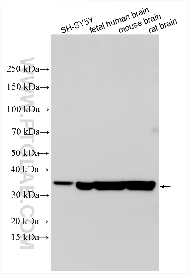 Various lysates were subjected to SDS PAGE followed by western blot with 23974-1-AP (EB3 antibody) at dilution of 1:4000 incubated at room temperature for 1.5 hours. WB analysis using 23974-1-AP
