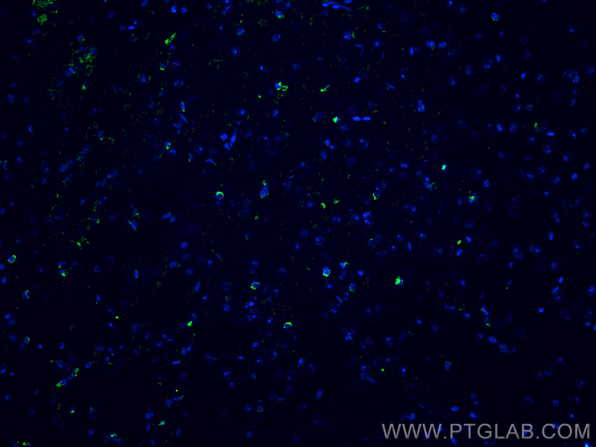 IF Staining of mouse brain using 10274-1-AP