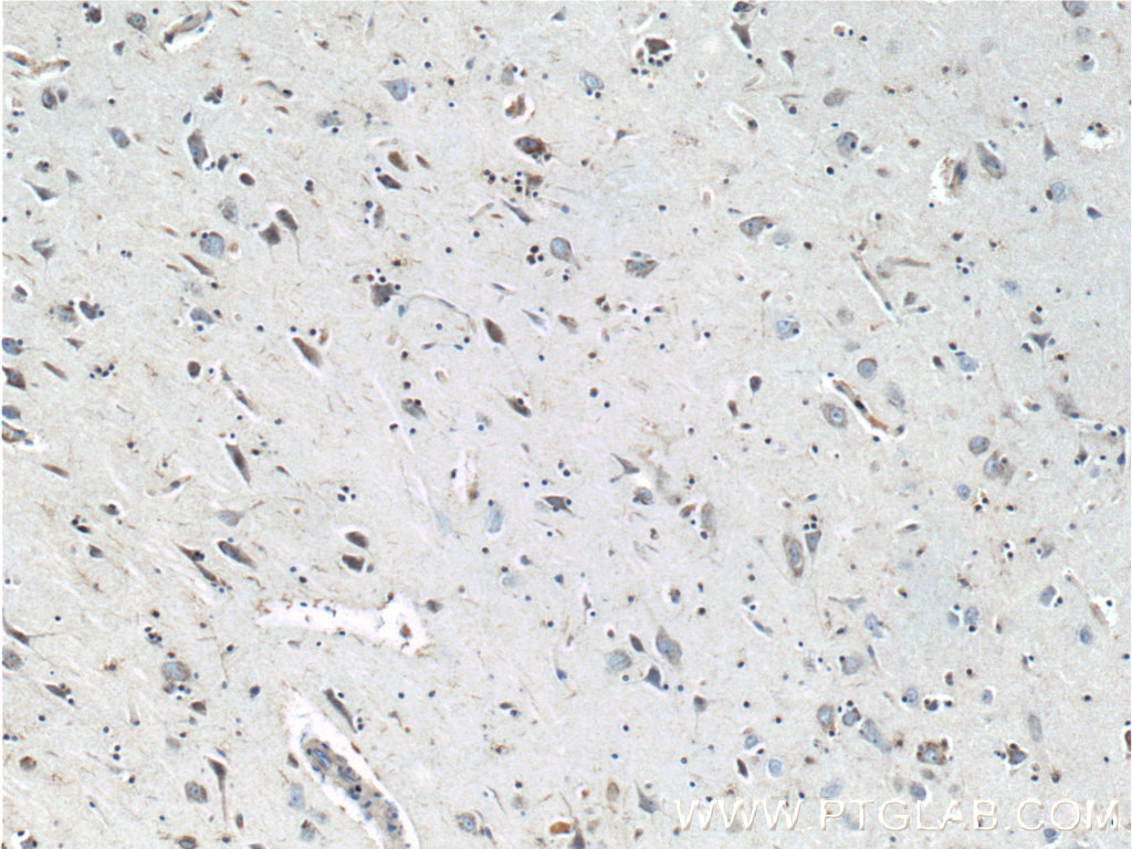 IHC staining of human brain using 10274-1-AP