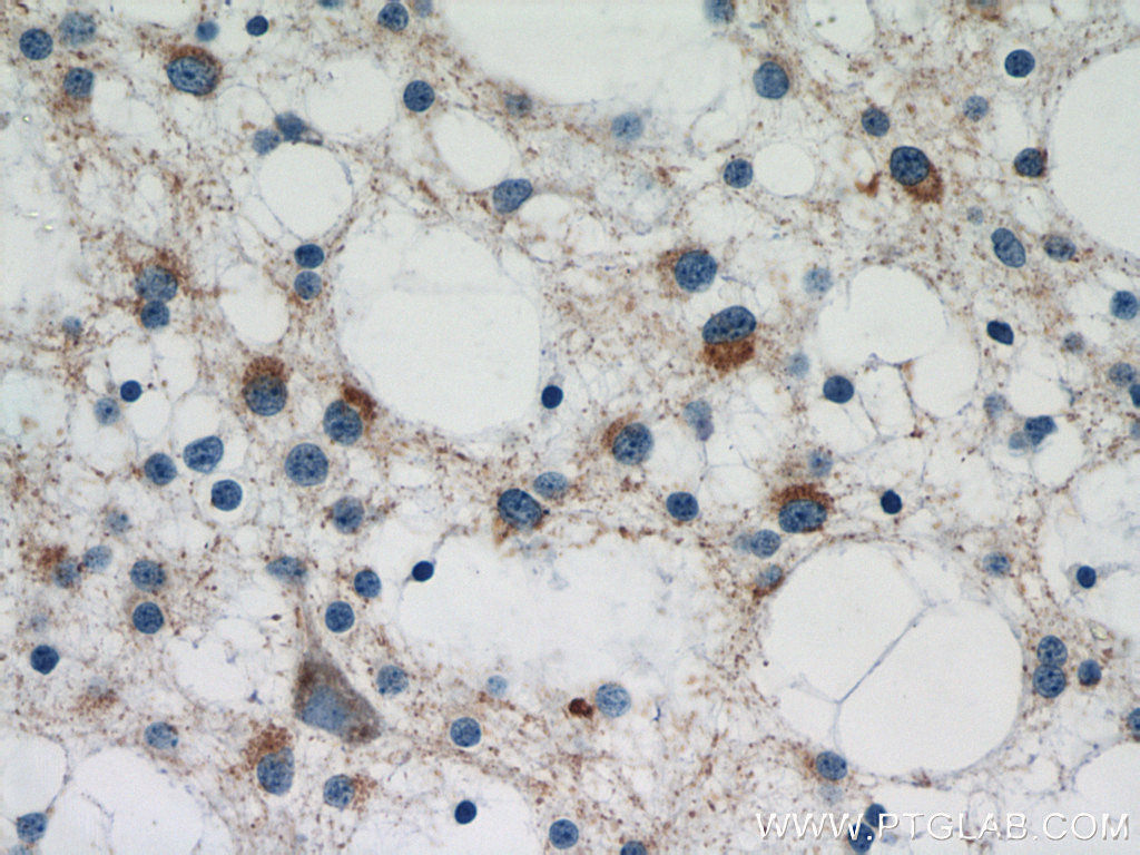 TAU Polyclonal antibody